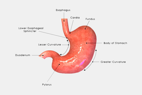Distal Gastrectomy (Stomach Cancer Surgery)