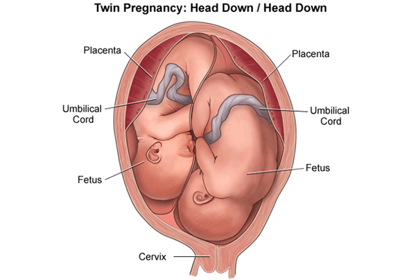 Twins/Multiple Pregnancy